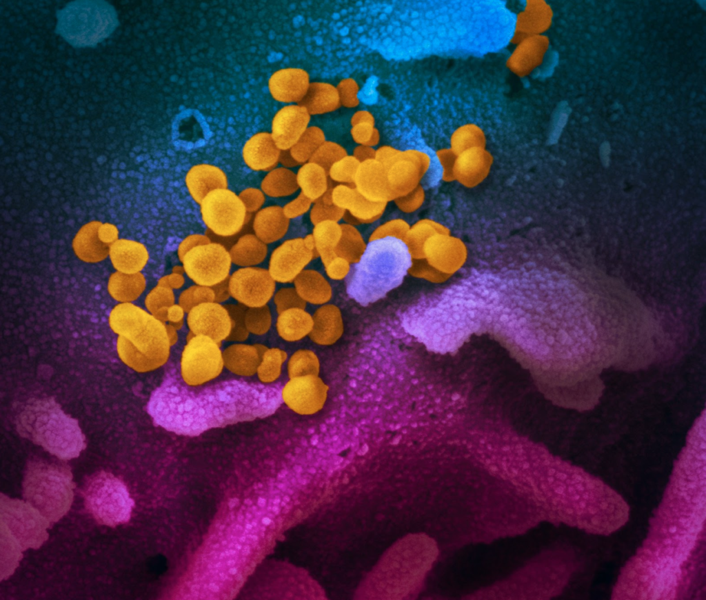 COVID-19 Virus under an electron microscope
