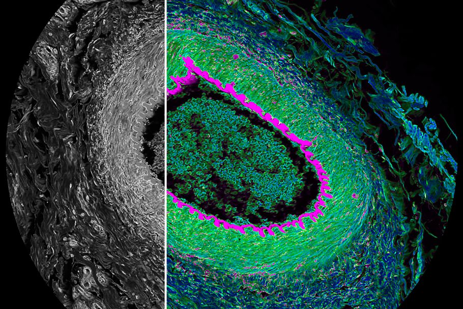 Histological section from cat eye. Simultaneous spectral (grey) and FLIM (color) confocal imaging reveals contrast by lifetime. Acquisition and visualization using Leica STELLARIS 8 FALCON and LAS X software. Courtesy Leica Microsystems