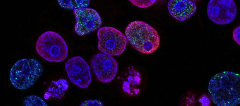 Cancer cells images using digital microscopes